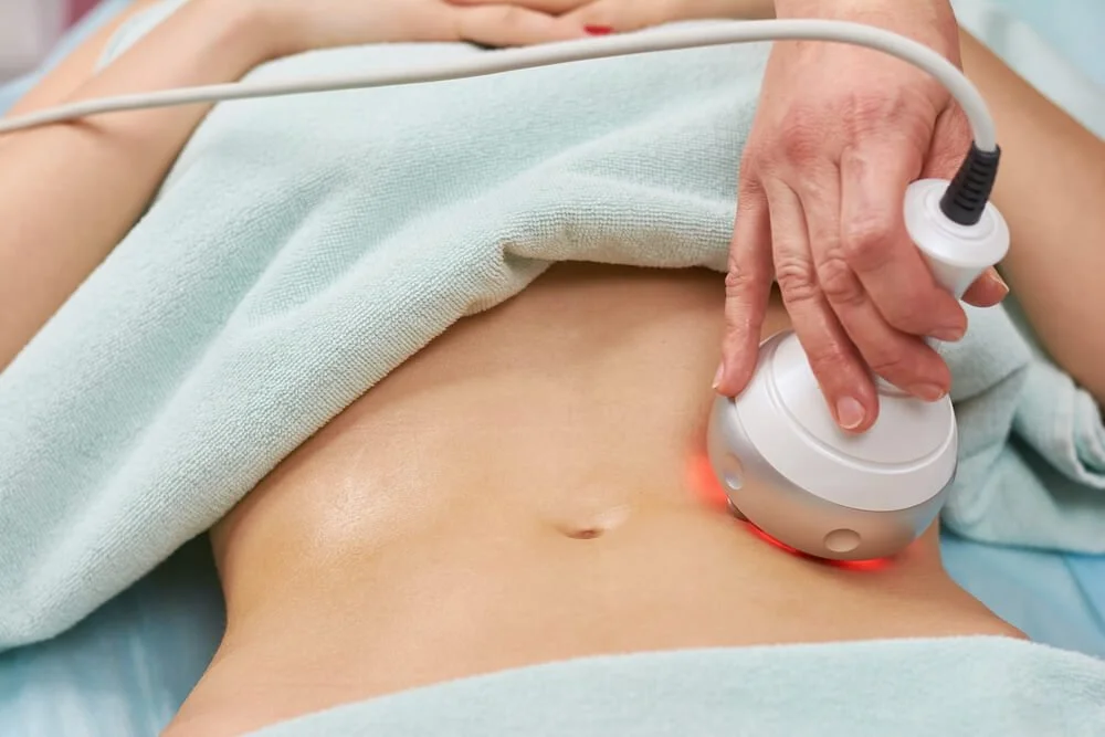 Body Sculpting: What is it & How Does it Work? 1 Could Radio Frequency Body Treatments Give You the Silhouette of Your Dreams RF 1