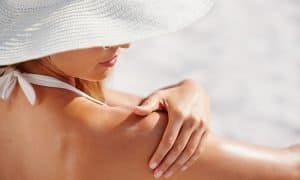 image of Plantation Best Treatments for Sun Damage
