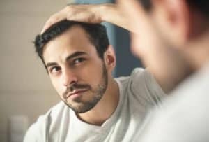 image of Hair Loss Treatments for Men