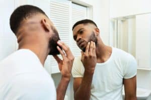 image of How to Treat Men's Acne