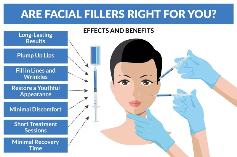 My First Time Getting Lip Fillers: Here’s What to Expect… 1 image of are face filler right for you? and effects and benefits images