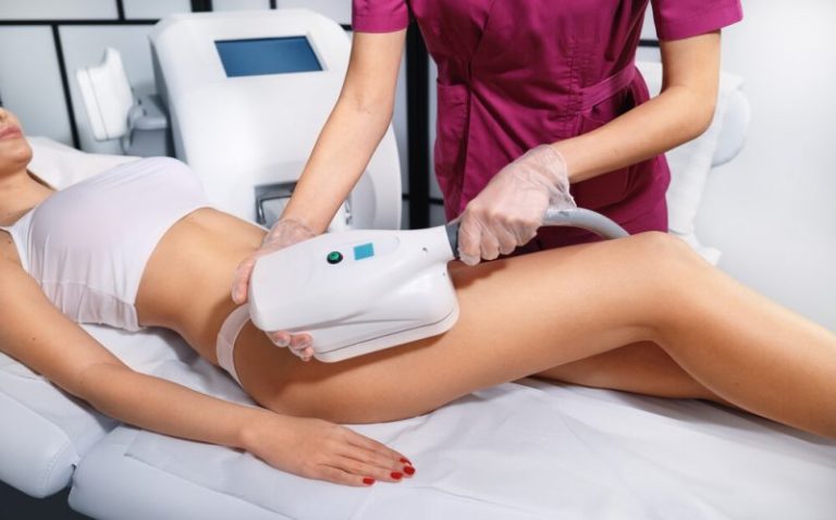 imagen de Vanquish Vs. CoolSculpting: ¿Cuál elegir?
