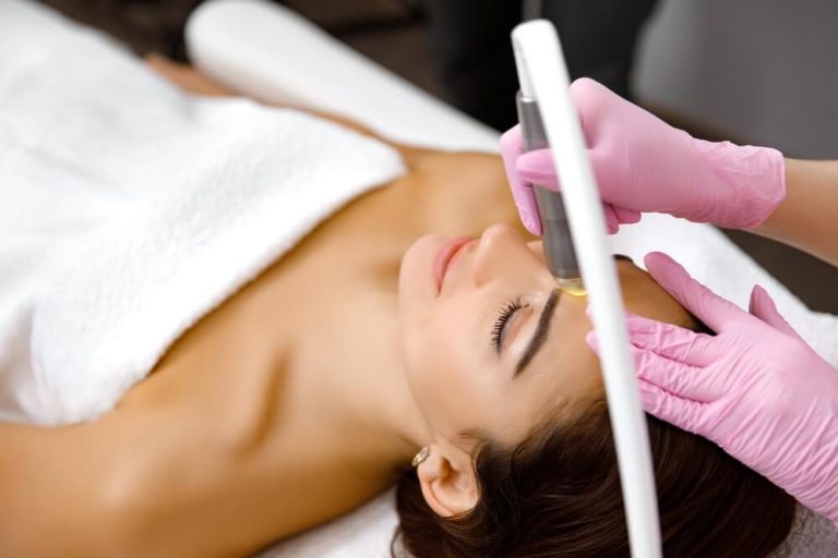 image of Cómo tratar la hiperpigmentación