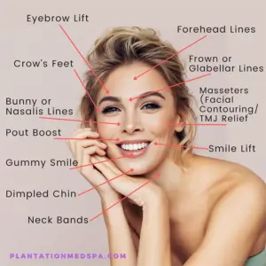 image of La Guía Definitiva del Botox: Beneficios, proceso y cuidados posteriores