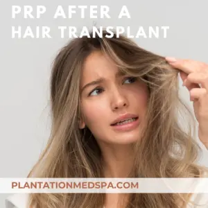 image of do I need PRP after a hair transplant?