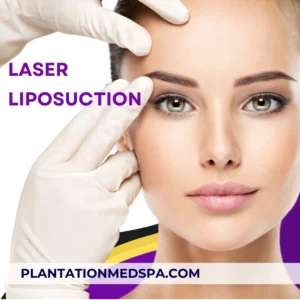 image for What Is Laser Liposuction For?