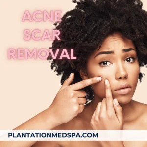 imagen de cómo reducir las cicatrices del acné tratamiento con Plex Plus