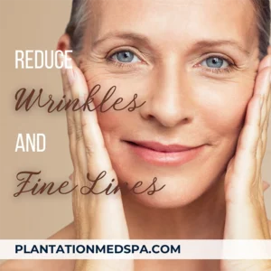 image of the top 4 treatments to reduce wrinkles and fine lines