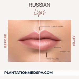 image of todo sobre los labios rusos una guía sencilla para unos labios bonitos