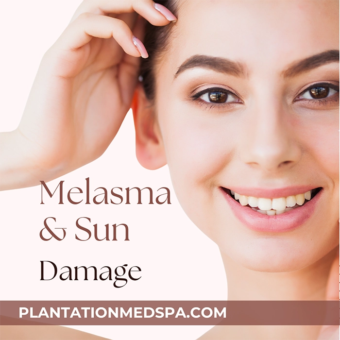 Melasma and sun-damage fixes with IPL in Plantation, Florida