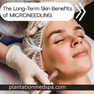 The Long-Term Skin Benefits of Microneedling