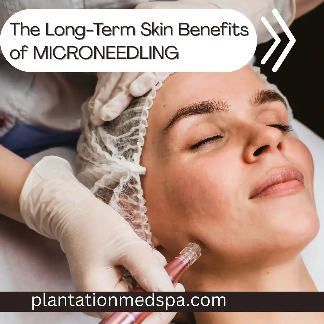 The Long-Term Skin Benefits of Microneedling