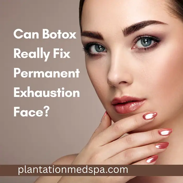 Can Botox Really Fix Permanent Exhaustion Face