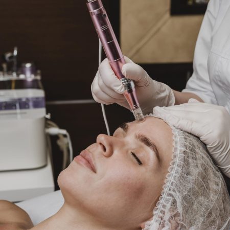 image of Best Radiofrequency Microneedling Treatment In West Palm Beach Gardens, Florida